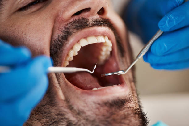 Best Dentist for Tooth Abscess  in Nipomo, CA